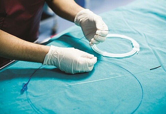 medical stent coiled on table